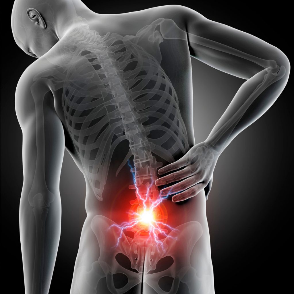 Physical Therapy for back pain in Yorkville