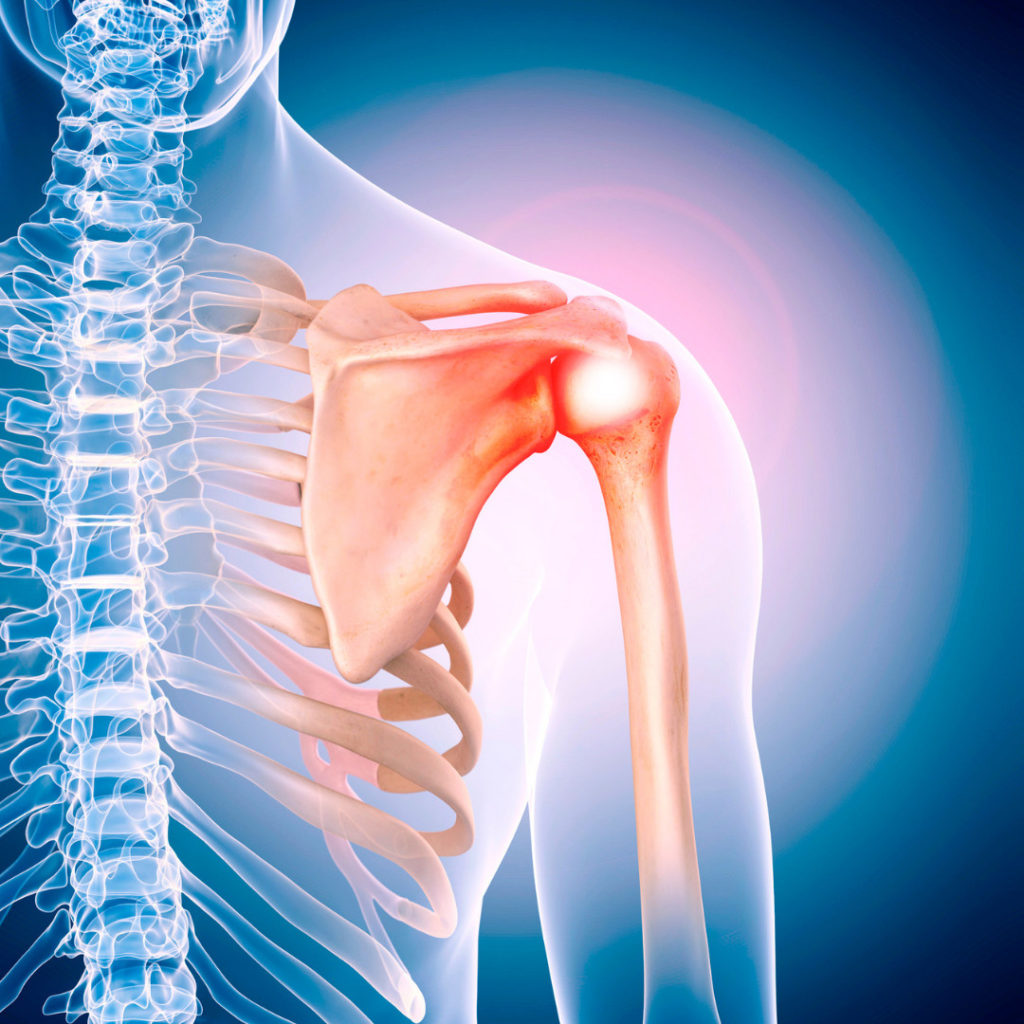 Physical Therapy for shoulder pain in New York City