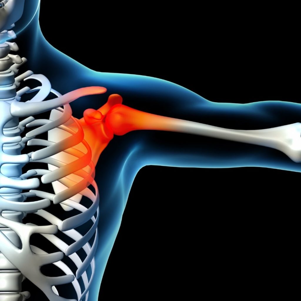 Shoulder Pain, Injuries, Treatment