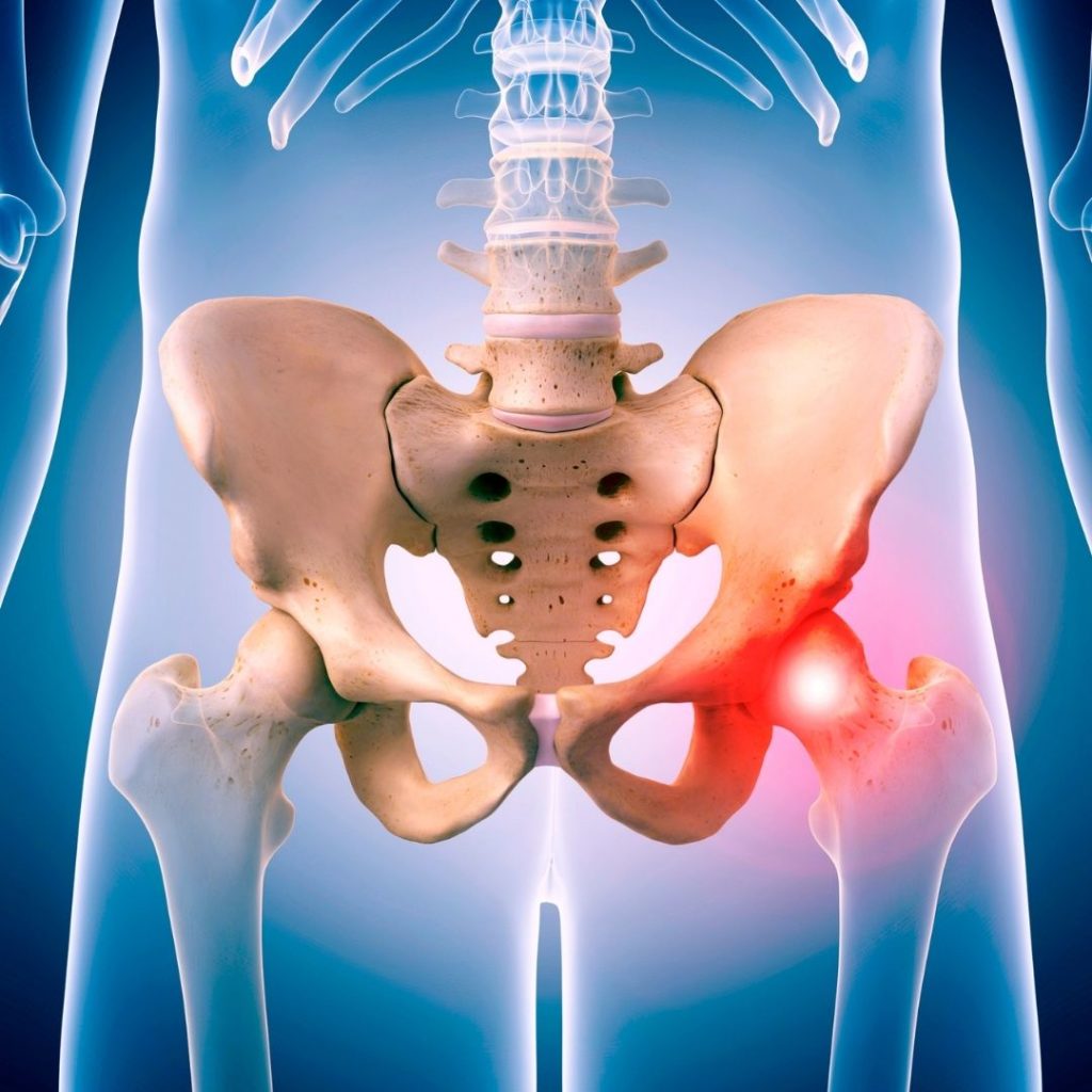 pelvic floor muscle pain & dysfunction therapy in NYC